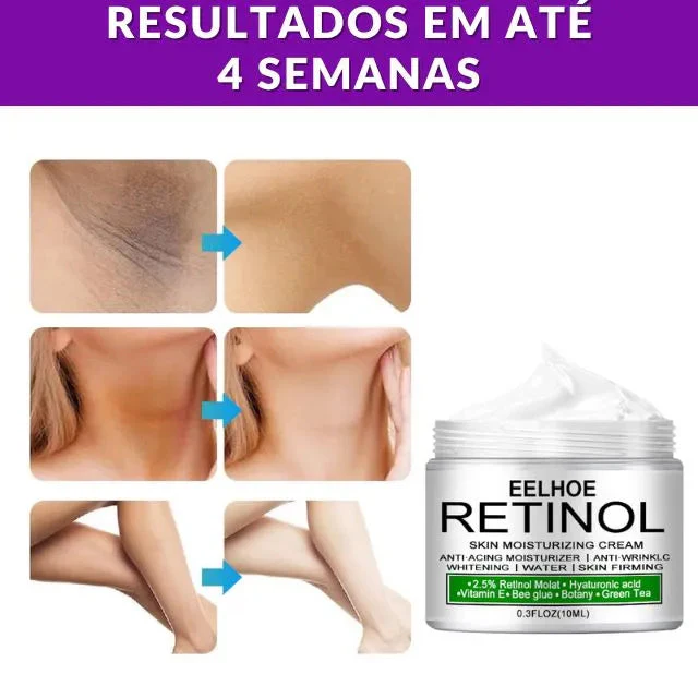 retinol-original-creme-clareador-facial-virilha-cotovelos-e-axilas-kaypestore-229108_640x Para Que Serve o Retinol? Benefícios, Como Usar e Melhores Produtos