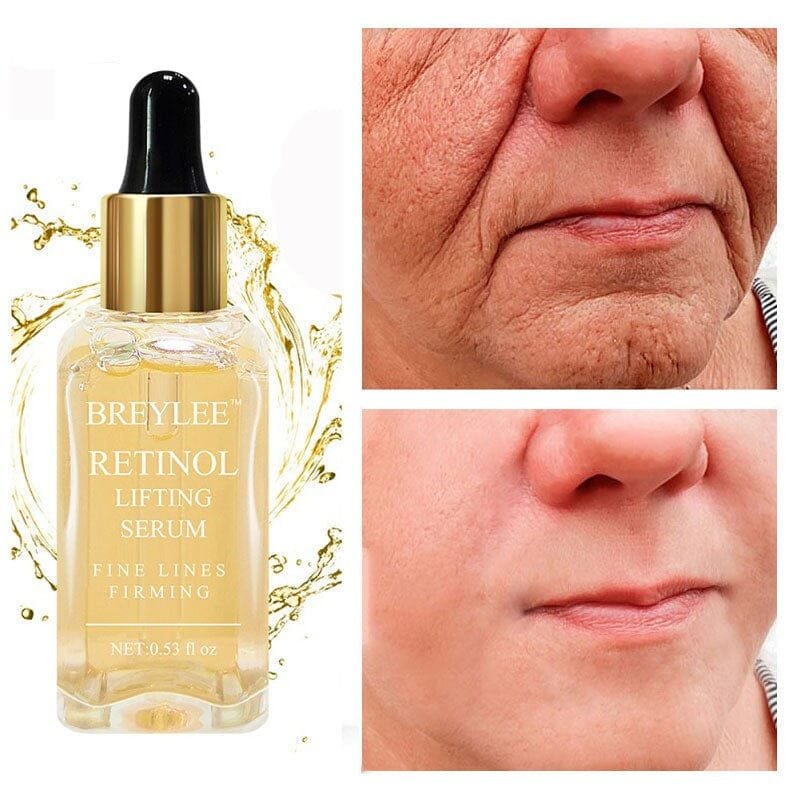 serum-retinol-anti-rugas-combate-linhas-de-expressao-olheiras-flacidez-e-vico-0-loja-609651_800x Para Que Serve o Retinol? Benefícios, Como Usar e Melhores Produtos