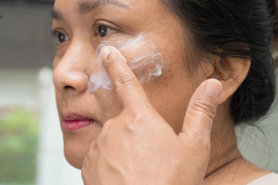 Tratamento-para-Melasma-6 Tratamento para Melasma 2025