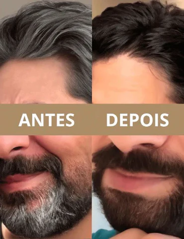 Clipboard02_400x_4e914a96-df20-416f-8428-33b8bdc507b3_480x480 Como Reverter Cabelo Branco Naturalmente – Melhores Dicas 2025