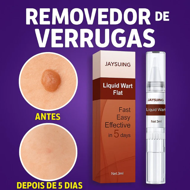 Removedor_de_Verrugas_Genitais_HPV_Tratamento_Natural_Masculino_e_Feminino_-_Kaype_STore-2 Verrugas Genitais: O Que São, Por Que Aparecem e Como Tratar com Segurança