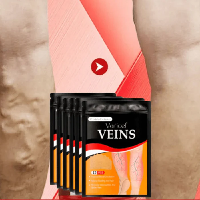 varicel-original-varicosamax-adesivo-de-varizes-dores-nas-pernas-joelho-e-ciatico-sa010-ort022-kaypestore-393827 10 Hábitos que Pioram Suas Varizes (e Como Evitar) - Guia Completo 2025