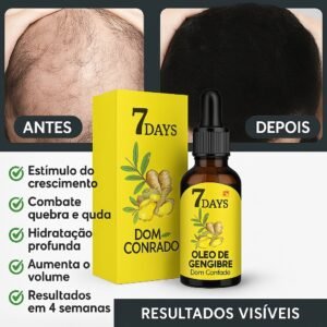 serum-gengibre-crescimento-capilar-domconrado-6-300x300 Principais Causas da Alopecia e Soluções Naturais 2025