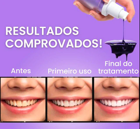 clareador-dental-serum-v34-kaypestore_2_480x480 Clareamento Dental em Casa: Como o Sérum V34 Pode Ajudar