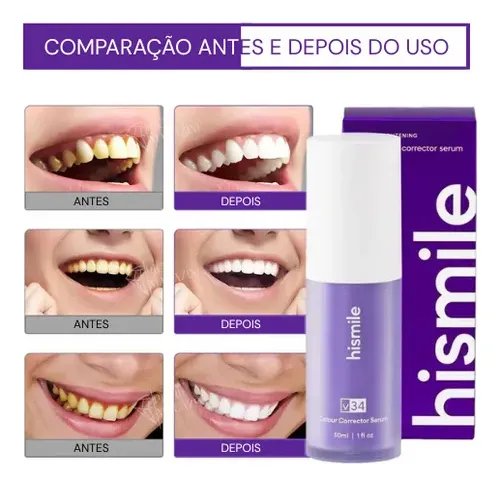 clareador-dental-serum-v34-kaypestore_3 Como Clarear os Dentes de Forma Segura e Rápida 2025