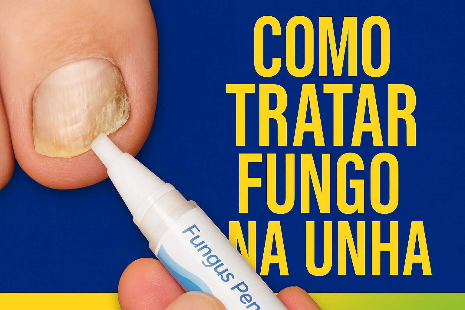 Como Tratar Fungo na Unha: Guia Completo para Eliminar Micose 2025 ...