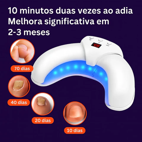 fungotherapy-terapia-unhas-kaypestore_4_480x480-1 Como Tratar Fungo na Unha: Guia Completo para Eliminar Micose 2025