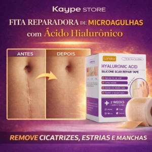 Fita-Reparadora-de-Microagulhas-com-Acido-Hialuronico-3-300x300 Por que Estrias e Cicatrizes se Formam? Causas, Tipos e Tratamentos Eficazes 2026