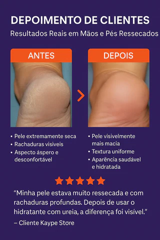 hidratante-profissional-pes-maos-ureia-42-acido-salicilico-kaype-store_5_480x480 Ureia Para a Pele: Para Que Serve e Quais Seus Benefícios Reais 2026
