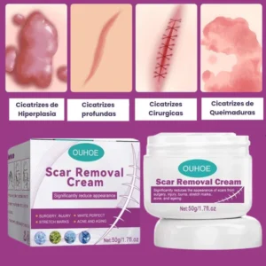 cicaremover-removedor-cicatrizes_3_175a266c-12a9-4673-8847-2362bd3e161f-300x300 Como Tratar Cicatrizes Sem Procedimentos Invasivos: Guia Completo 2026