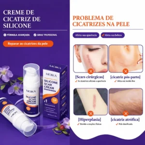 kit-2-moika-creme-cicatrizes-estrias-marcas-acne_2_e0ce9e37-f315-4f37-838a-731cf05d5340-300x300 Como Tratar Cicatrizes Sem Procedimentos Invasivos: Guia Completo 2026