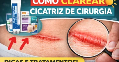 Como Clarear Cicatriz de Cirurgia