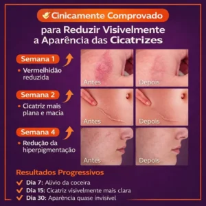 scar-removal-cream-creme-cicatrizes-kaype-store_1_7f73ebdf-2dc8-4e16-a444-3c258f5b06f6-300x300 Como Clarear Cicatriz de Cirurgia: Dicas, Tratamentos e Cuidados Essenciais 2026